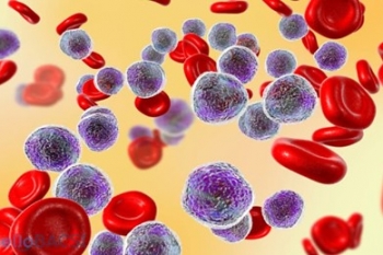 Tổng quan về bệnh Bạch Cầu Tủy Bào Cấp Tính – Ung thư máu cấp tính. (Acute Myeloid Leukaemia - AML)