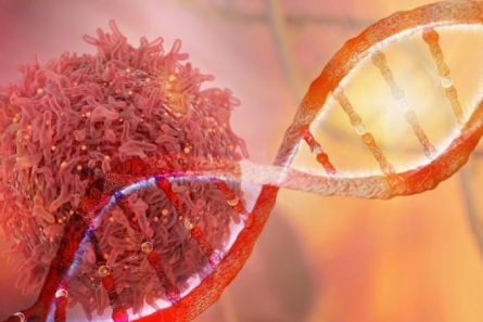 Yếu tố di truyền: Ung thư vú có tính di truyền không? Nếu có người nhà ung thư vú thì nên làm thế nào?